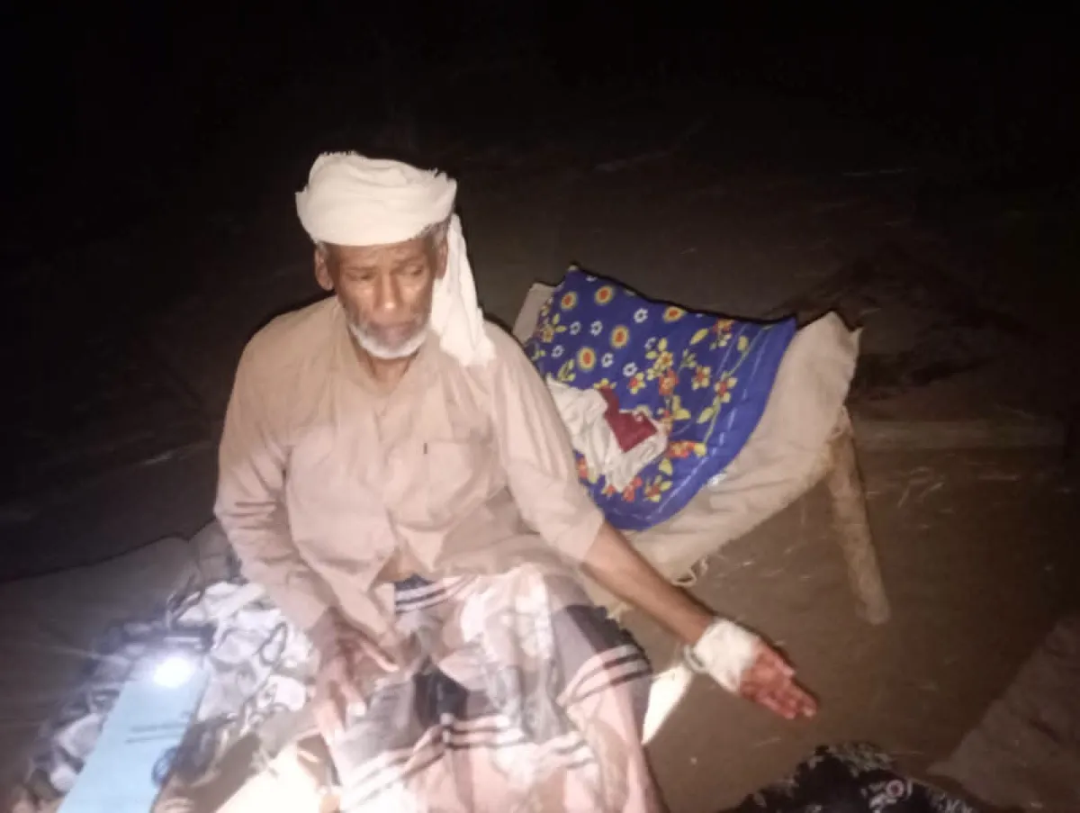 إصابة مدني بقصف حوثي استهدف منزله بالحديدة